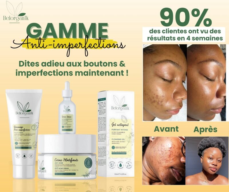 Gamme anti-imperfections – Image 3